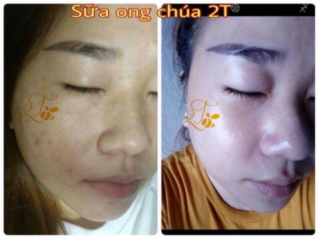 SỮA ONG CHÚA 2T