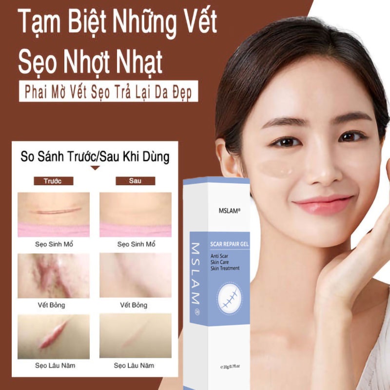 Kem che sẹo Giảm bỏng và bỏng nước Vết thương phẫu thuật v.v.mờ sẹo thâm mụn,mờ thâm ,khổi phục da,Kem chuyên xóa sẹo lồi lâu năm.