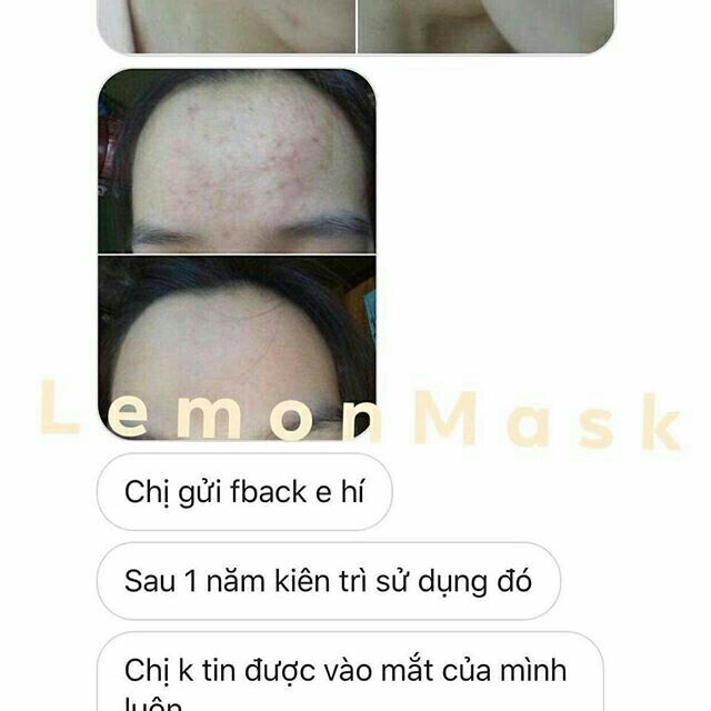 LEMONBEAUTY CHỈ VỚI 1 LIỆU TRÌNH DA SDẸP SUỐT ĐỜI TẠI SAO KHÔNG THỬ 😻😚 240k/LIỆU TRÌNH TẶNG KÈM CỌ+THẢO MỘC XÔNG MẶT