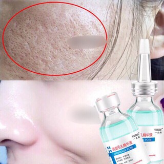 Tinh chất dưỡng shrinkage pore(I-318)