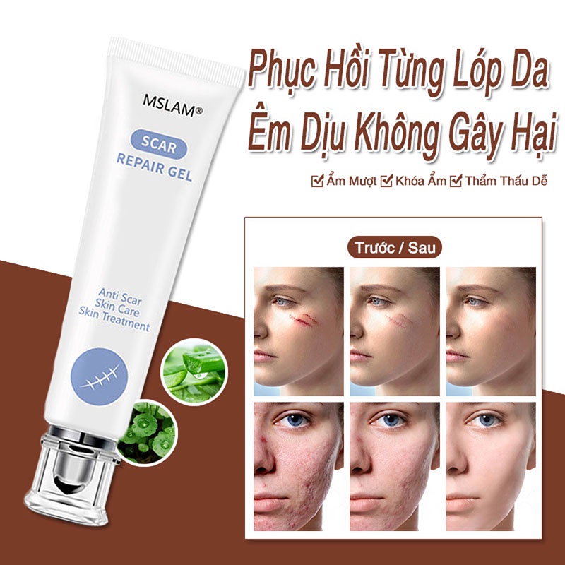Kem che sẹo Giảm bỏng và bỏng nước Vết thương phẫu thuật v.v.mờ sẹo thâm mụn,mờ thâm ,khổi phục da,Kem chuyên xóa sẹo lồi lâu năm.