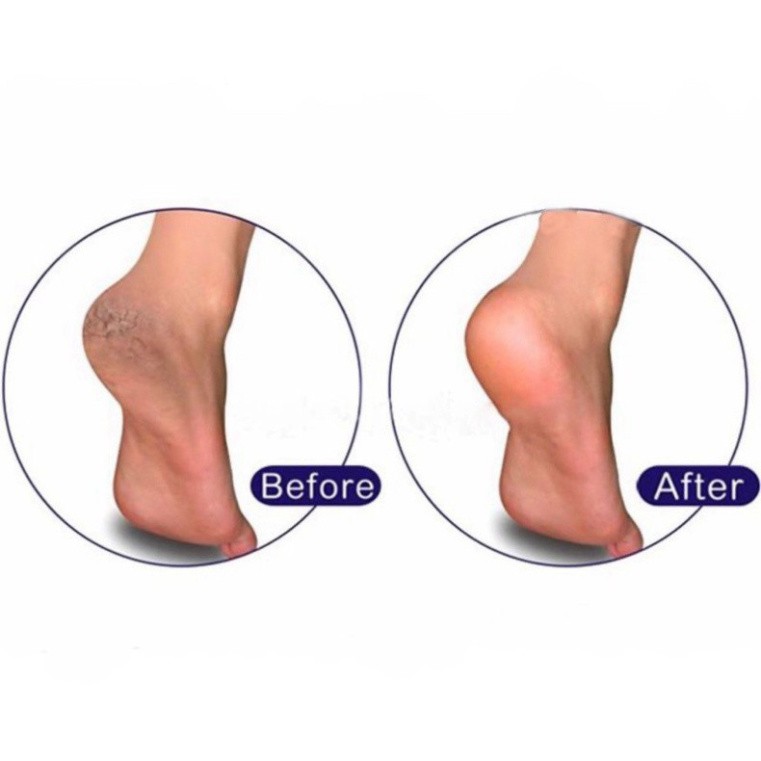 Mặt lưỡi chà gót chân thay thế - dụng cụ chà gót chân inox 304 chuyên dụng cho dân làm móng N26
