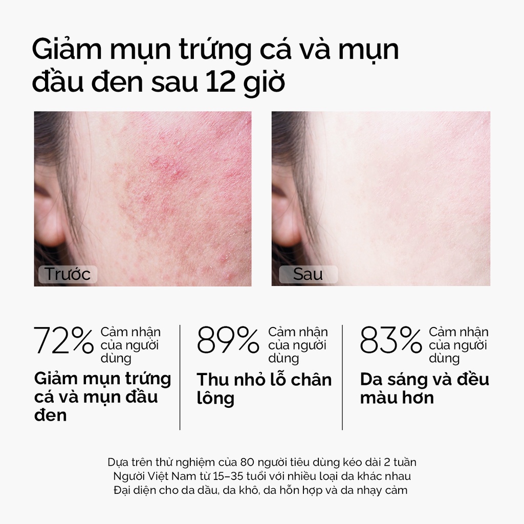 [Bạn mới nhập COSHBM -50% đơn 0Đ] SKINTIFIC MUGWORT ANTI PORES & MẶT NẠ ĐẤT SÉT MỤN 55g | WebRaoVat - webraovat.net.vn