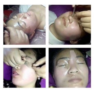 Mặt Nạ Collagen Tế Bào Gốc Trắng Da