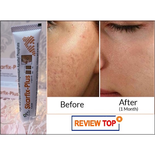 Kem Dưỡng Mờ Sẹo, Tàn Nhang, Thâm Nám, Làm Sáng Da FIXDERMA Scar Gel &amp; Skarfix Plus Cream