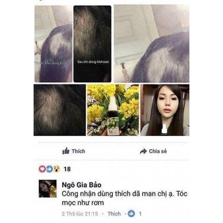 Xịt Tinh Dầu Mọc Tóc Mahaad Thái Lan