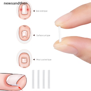 Set 10 miếng dán chỉnh hình móng chân mọc ngược tiện dụng