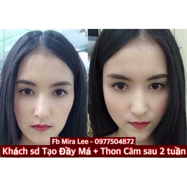 Tinh Chất Làm Đầy Má Miracle