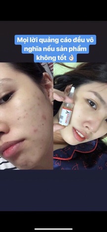 Serum Biểu Bì Thực Vật Vaurora 💦