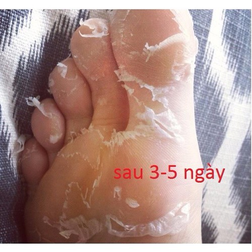 [Cam Kết Chuẩn Auth] tẩy tế bào chai sần bàn chân tự nhiên Smile Foot Peeling Mask