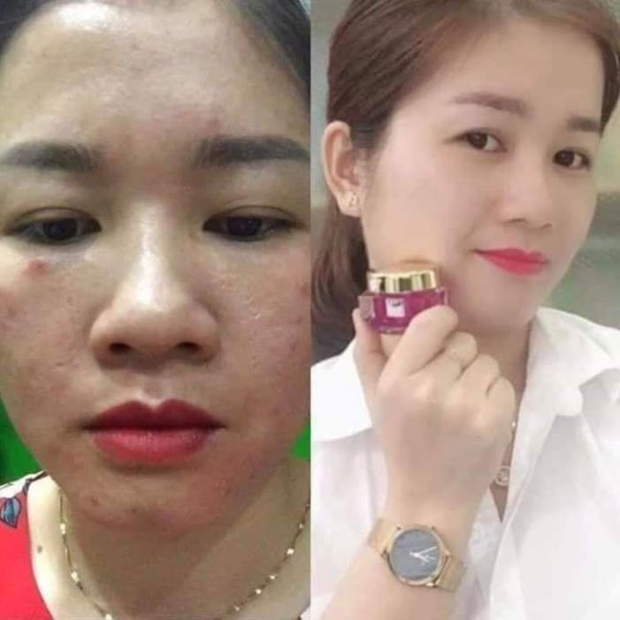 Kem Face Tím, Whitening Face Cream N'COLLAGEN + Ủ Trắng Face Siêu Cấp Ncollagen