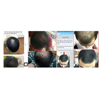 ✅ Tinh dầu Xịt tóc HYRA 👍[Freeship] ❤️