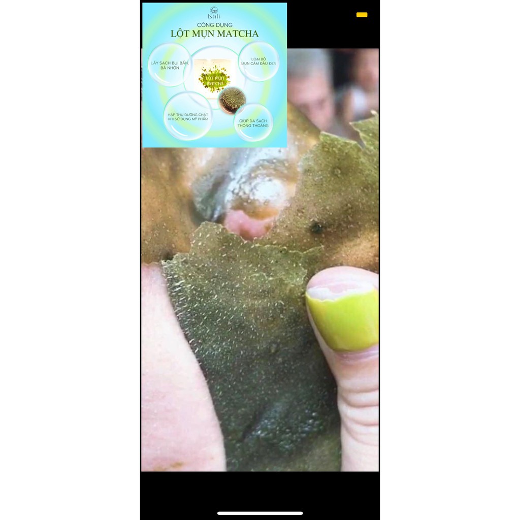 LỘT MỤN MATCHA TRÀ XANH | BigBuy360 - bigbuy360.vn