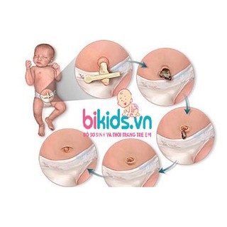 Băng rốn trẻ sơ sinh Hải Sơn Pha ( hộp 3 băng+ 3 gạc)