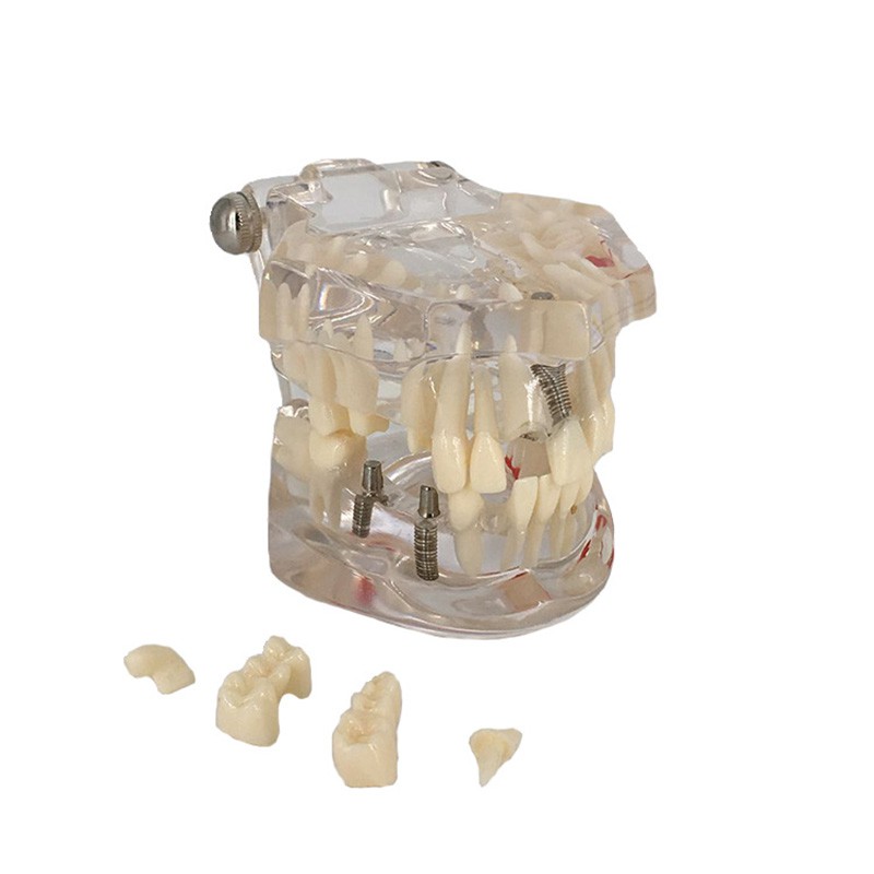 Mô hình hàm răng đa năng chuyên dụng dành cho nha khoa