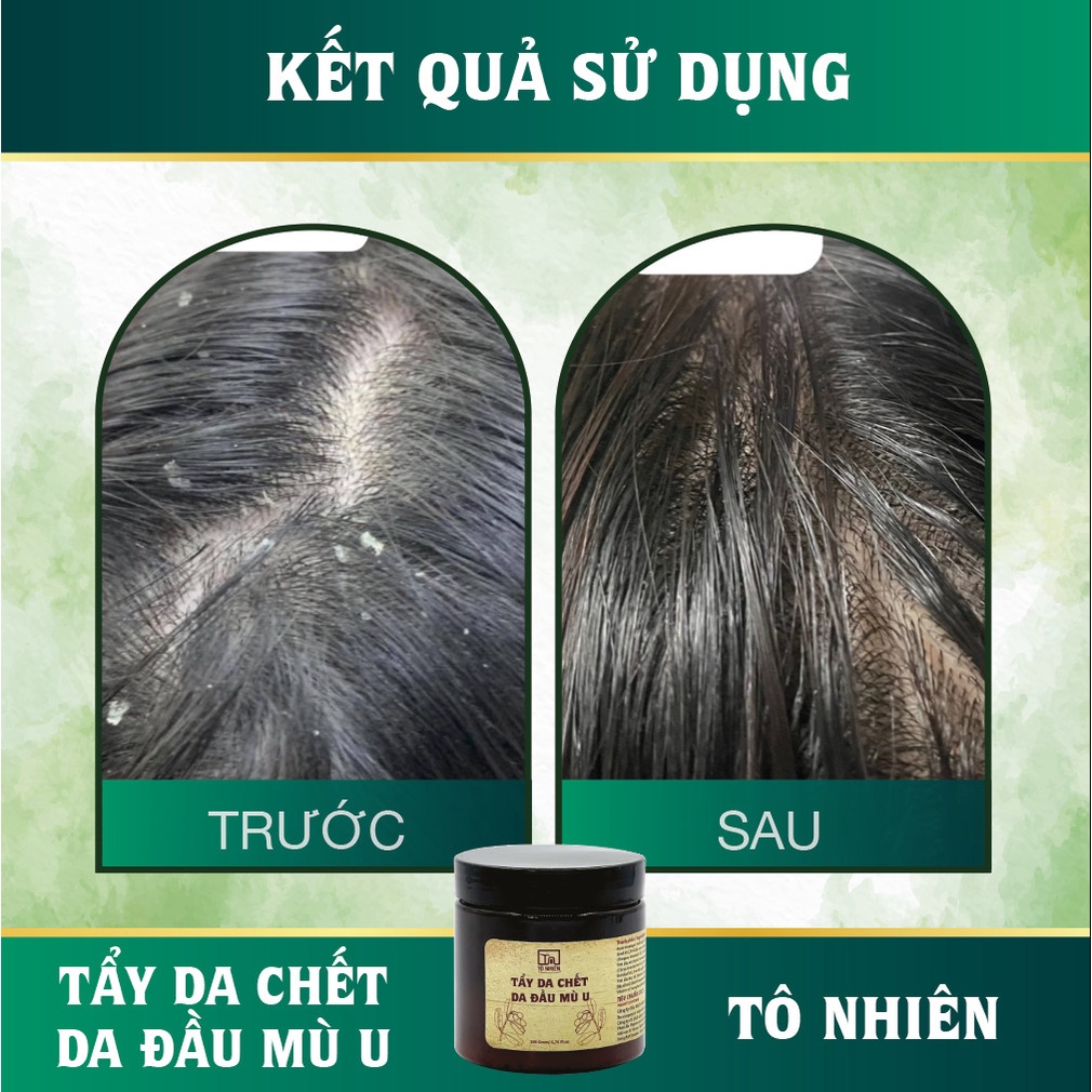 Tẩy da chết da đầu mù u Tô Nhiên giúp chân nang tóc phát triển khỏe mạnh, sạch bụi bẩn tích tụ ở da đầu, hũ 200g