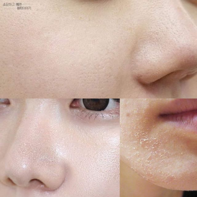 3 ống huyết thanh trắng da + 1 hũ kem tế bào gốc 4D Dr.laksmira