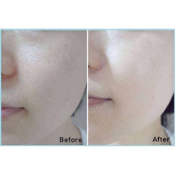 KEM BB THẠCH AQUA PEPTIT JELLY