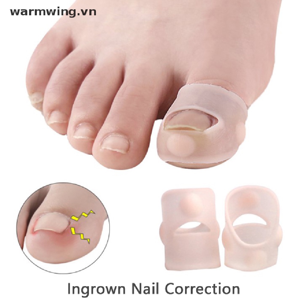 1 Cặp Dụng Cụ Silicone Chỉnh Hình Móng Chân Mọc Ngược