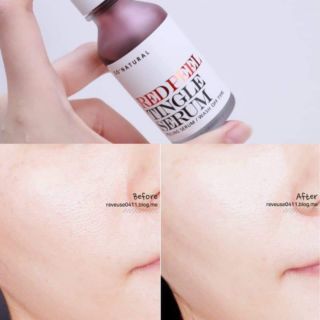 Serum Red peel