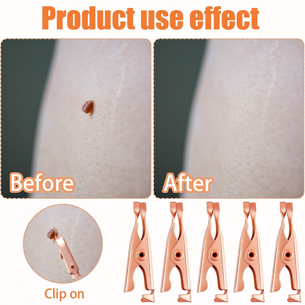 Bộ 2 Dụng Cụ Kẹp Loại Bỏ Thẻ Trên Da / Thẻ Xăm Nhỏ Bằng Đồng