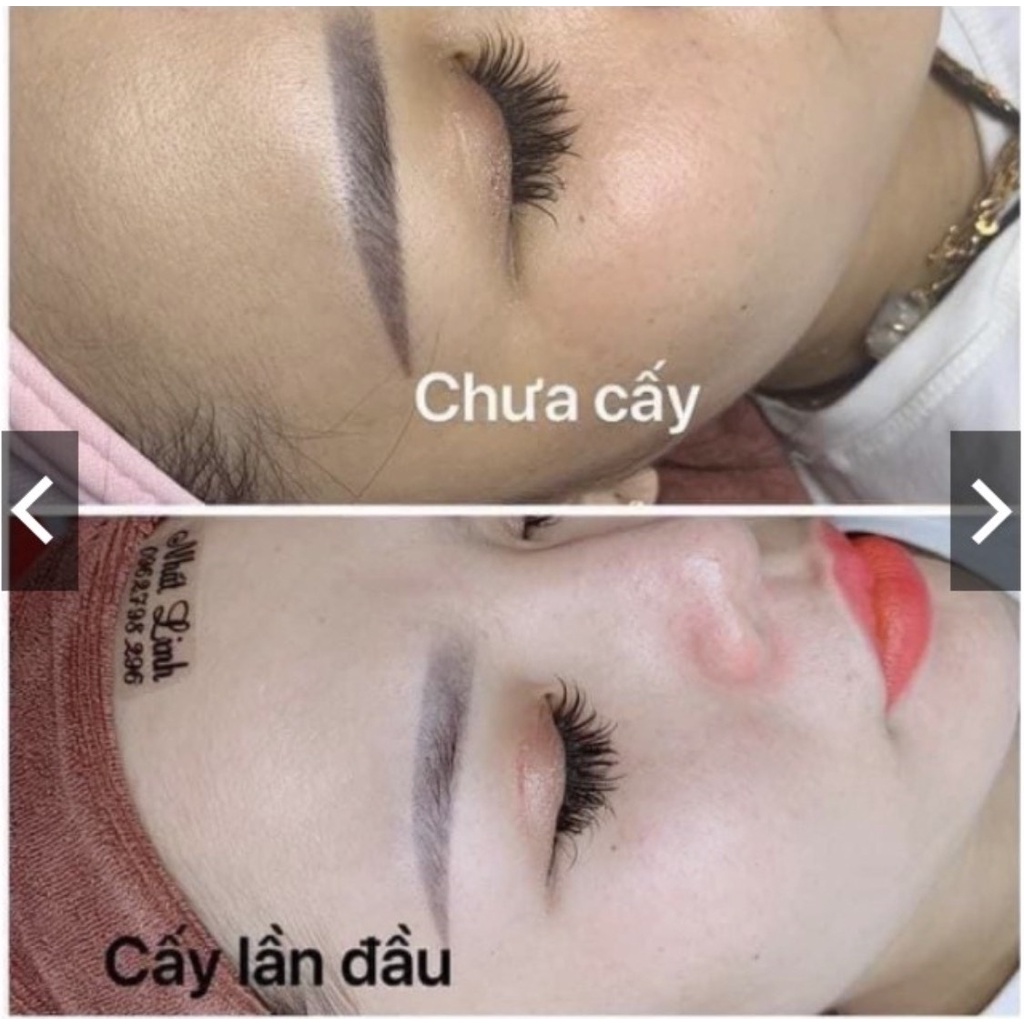 Cấy trắng Lụa . Cấy Trắng Lụa Hoàng Gia . Mask Lụa Hoàng Gia
