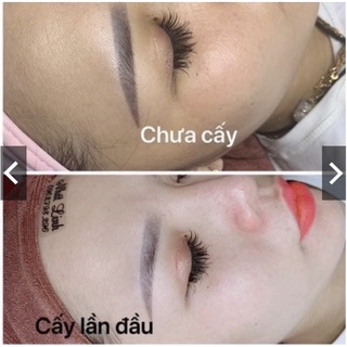 Cấy trắng Lụa . Cấy Trắng Mask Lụa Hoàng Gia