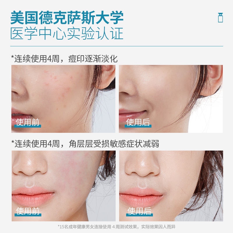 Ehrlich tinh chất oligopeptide phục hồi làm trắng da hỗ trợ giảm mụn dưỡng ẩm làm trắng da | BigBuy360 - bigbuy360.vn