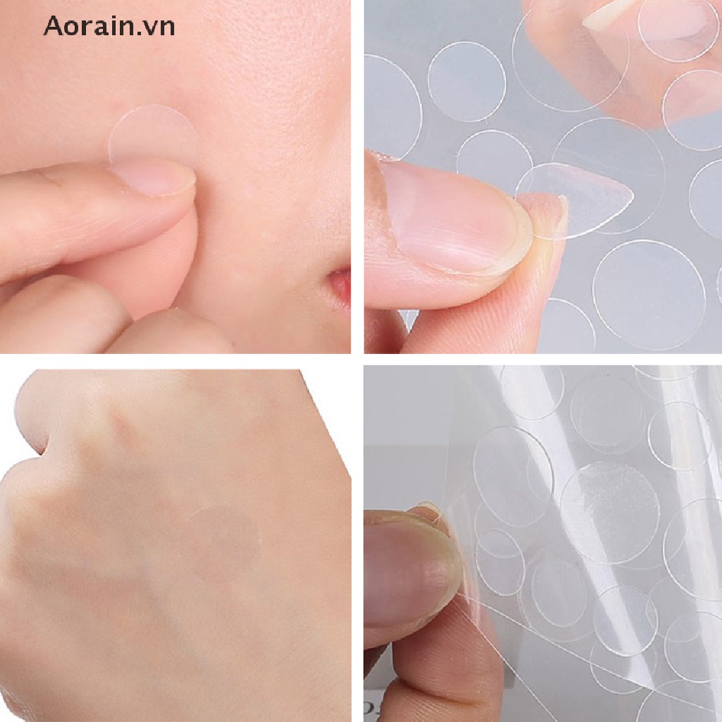 Bộ Miếng Dán Hỗ trợ giảm mụn Và Kiềm Dầu Hiệu Quả