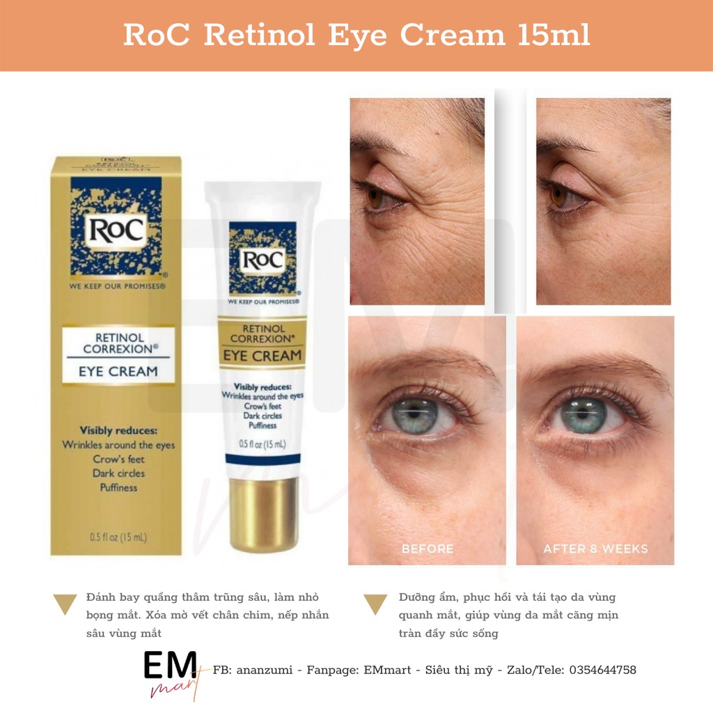 [BILL US] Kem mắt retinol ROC và serum huyết thanh Retinol ngừa lão hóa | BigBuy360 - bigbuy360.vn