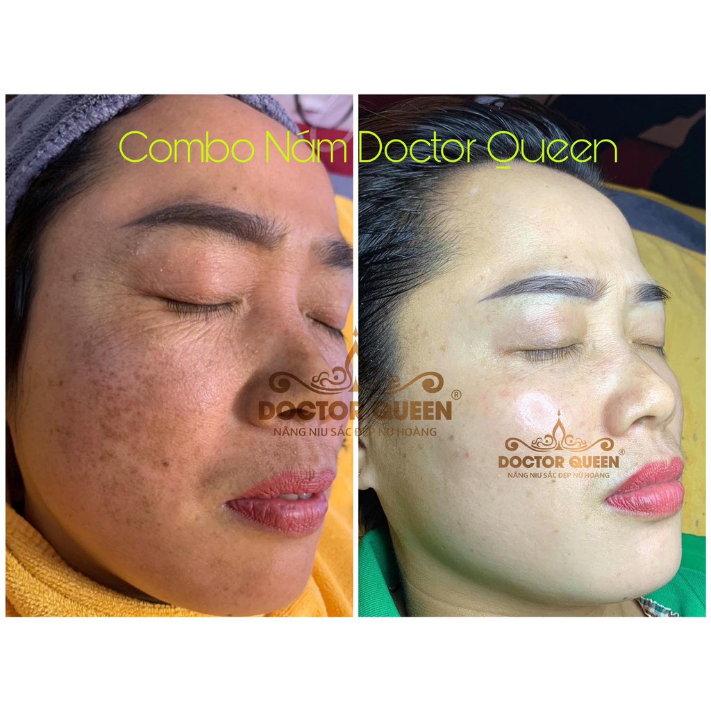 DETOX MUN DOCTOR QUEEN