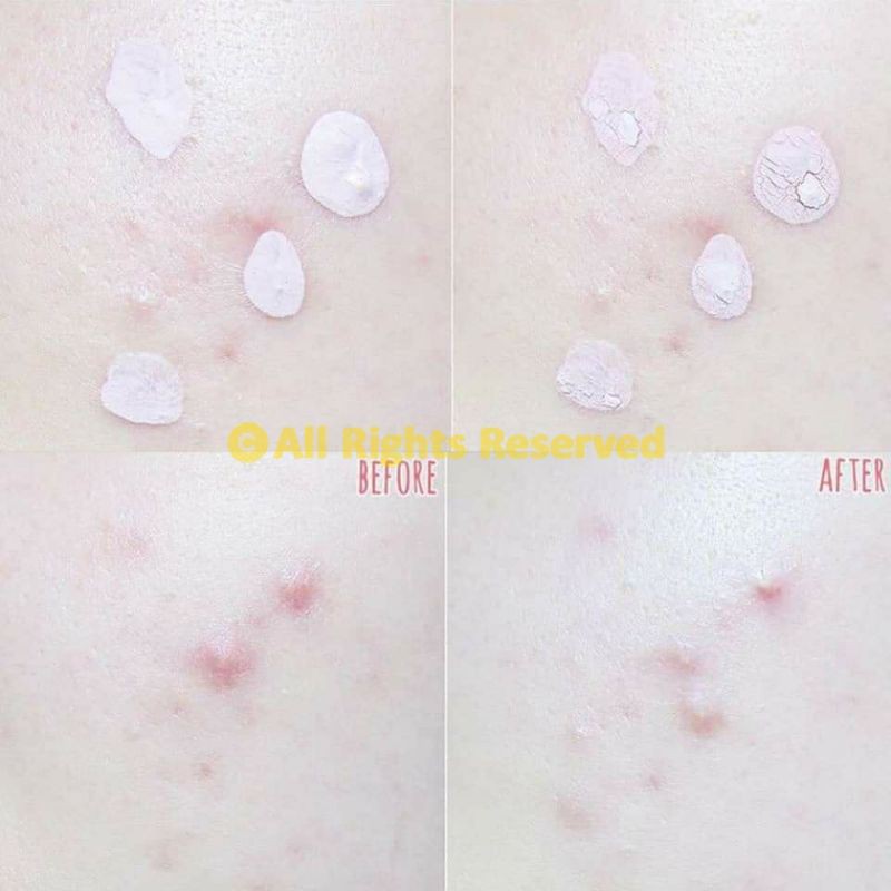 (XẢ KHO) (Date 08-2022) Dung dịch chấm mụn Mediheal A-Zero Shot Skin Control Pink Dressing | BigBuy360 - bigbuy360.vn