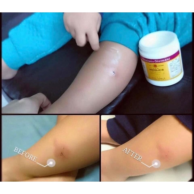 Kem bôi lành vết thương Oronine H Ointment nội địa Nhật Bản 30g, 100g