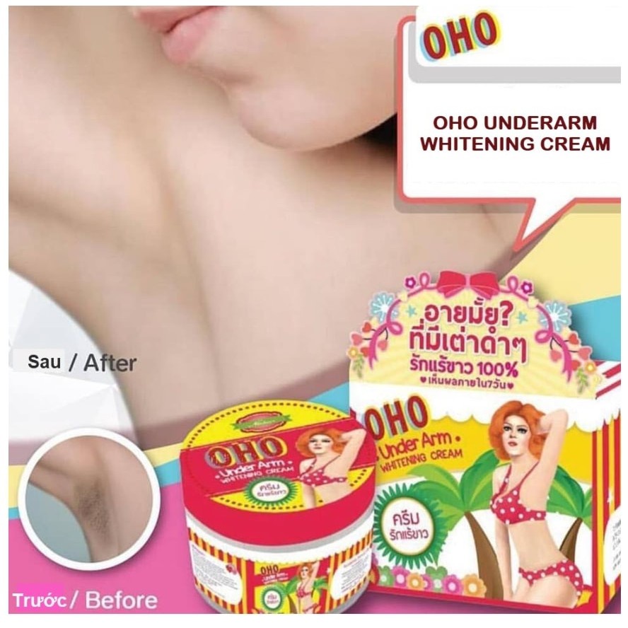 Kem khử thâm nách Oho Underarm Whitening Cream