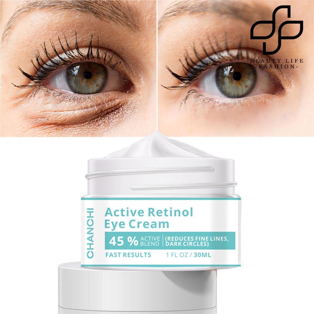 [Hàng mới về] Kem dưỡng da mắt retinol làm sáng da chăm sóc loại bỏ bọng mắt hiệu quả nhanh chóng