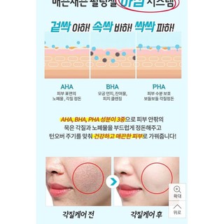 Tẩy tế bào chết Prreti Peeling Gel