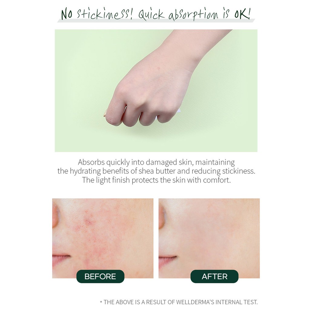 Kem giúp làn da nhạy cả hồi phục thật nhanh Wellderma Cica Treatment Repair Daily Cream 50ml