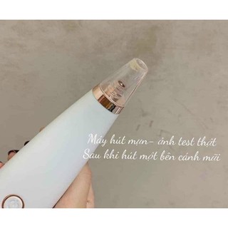 MÁY HÚT MỤN CẦM TAY