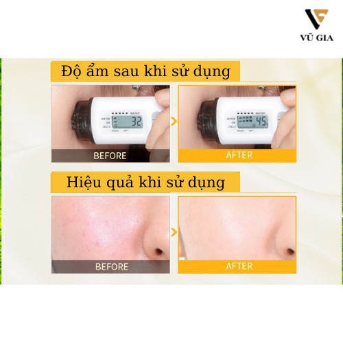 Kem Dưỡng Ẩm, Kem Dưỡng Trắng Da Mặt Mỡ Cừu LAIKOU Chống Lão Hóa 90g | BigBuy360 - bigbuy360.vn