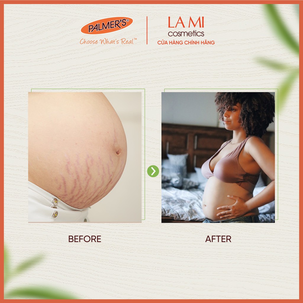 Bơ đậm đặc ngăn ngừa và chống rạn da tăng cường Palmer's 125g | BigBuy360 - bigbuy360.vn