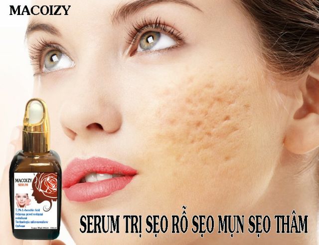 Serum Sẹo Rỗ Tái Tạo Da Se Khích Lỗ Chân Lông