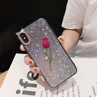 ỐP HOA ĐÁ RUBY