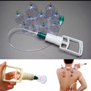 BỘ GIÁC HƠI KHÔNG DÙNG LỬA 10 ỐNG AN TOÀN SỬ DỤNG