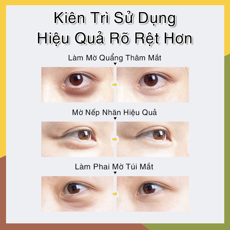 VIBRANT GLAMOUR Kem Mắt Cá Sấu Làm Mờ Quầng Thâm Quầng Mắt Nếp Nhăn Mắt Và Dưỡng Da Quanh Vùng Mắt  20g