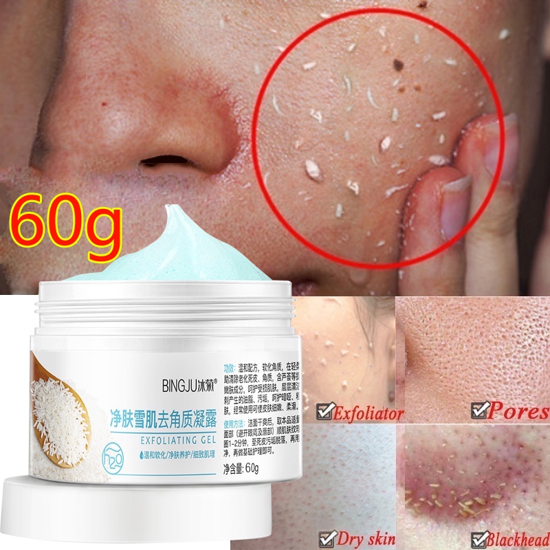 Gel tẩy tế bào chết làm sạch sâu loại bỏ mụn đầu đen hiệu quả