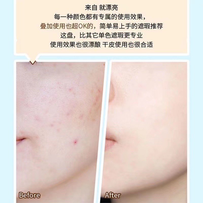 Kem Che Khuyết Điểm Kiss Beauty Sáu Màu Che Phủ Quầng Thâm Và Bọng Mắt Làm Sáng Da