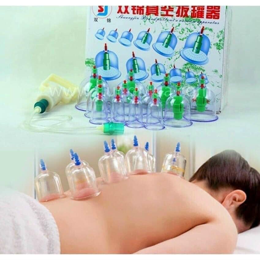 Bộ sản phẩm giác hơi tại nhà cực kỳ tiện lợi không cần lửa