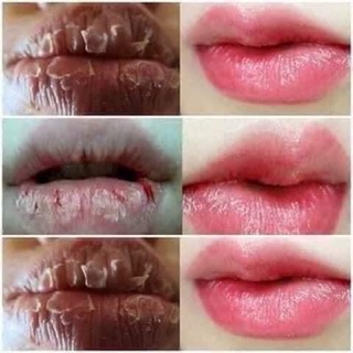 Sáp dưỡng hồng môi - mềm - mịn loại bỏ khô nức almonds