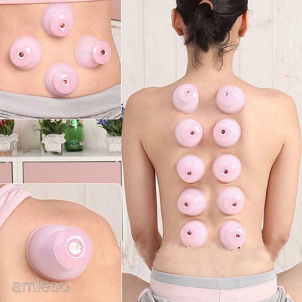 Cốc hút chân không massage cơ thể phong cách Trung Quốc bằng silicon