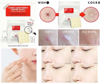 Miếng dán hút mụn Cosrx